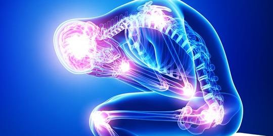 fibromyalgia