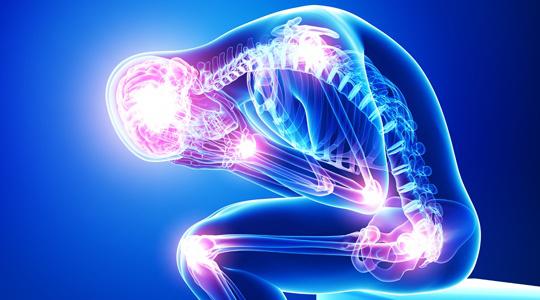 fibromyalgia