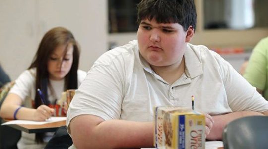 Obesity
