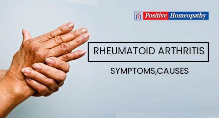 Rheumatoid Arthritis Homeopathy Treatment | Early Signs and Symptoms