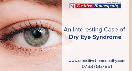 Dry Eye Syndrome | Eye Syndrome Treatment | Dr Positive Homeopathy