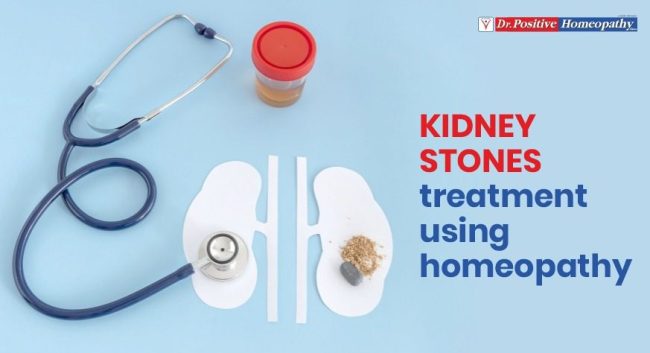 Kidney Stones Treatment Using Homeopathy