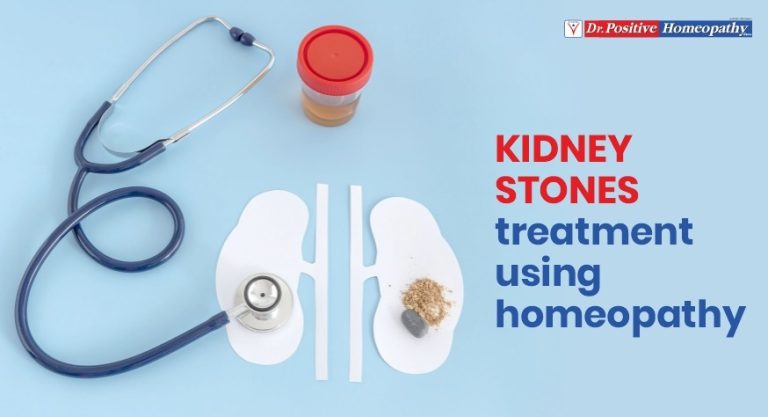 Kidney Stones Treatment Using Homeopathy