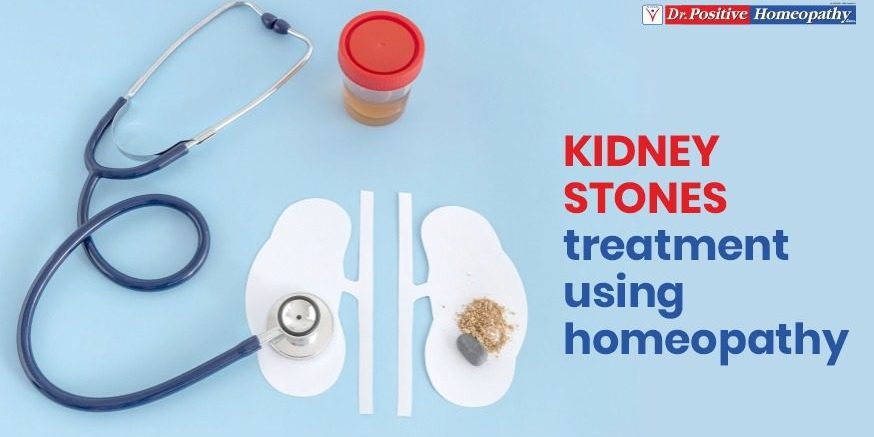 Kidney Stones Treatment Using Homeopathy