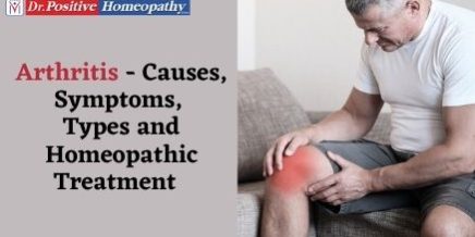 Arthritis Treatment Using Homeopathy Arthritis Treatment Using Homeopathy