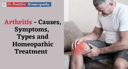 Arthritis Treatment Using Homeopathy Arthritis Treatment Using Homeopathy