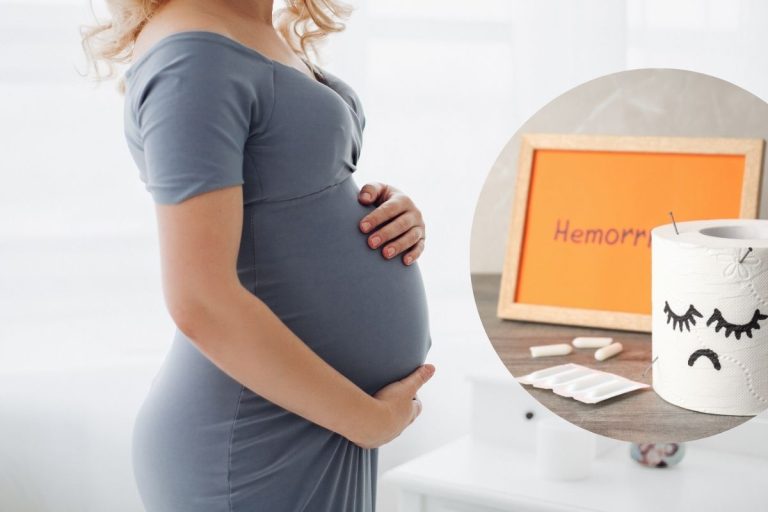 Piles after Pregnancy